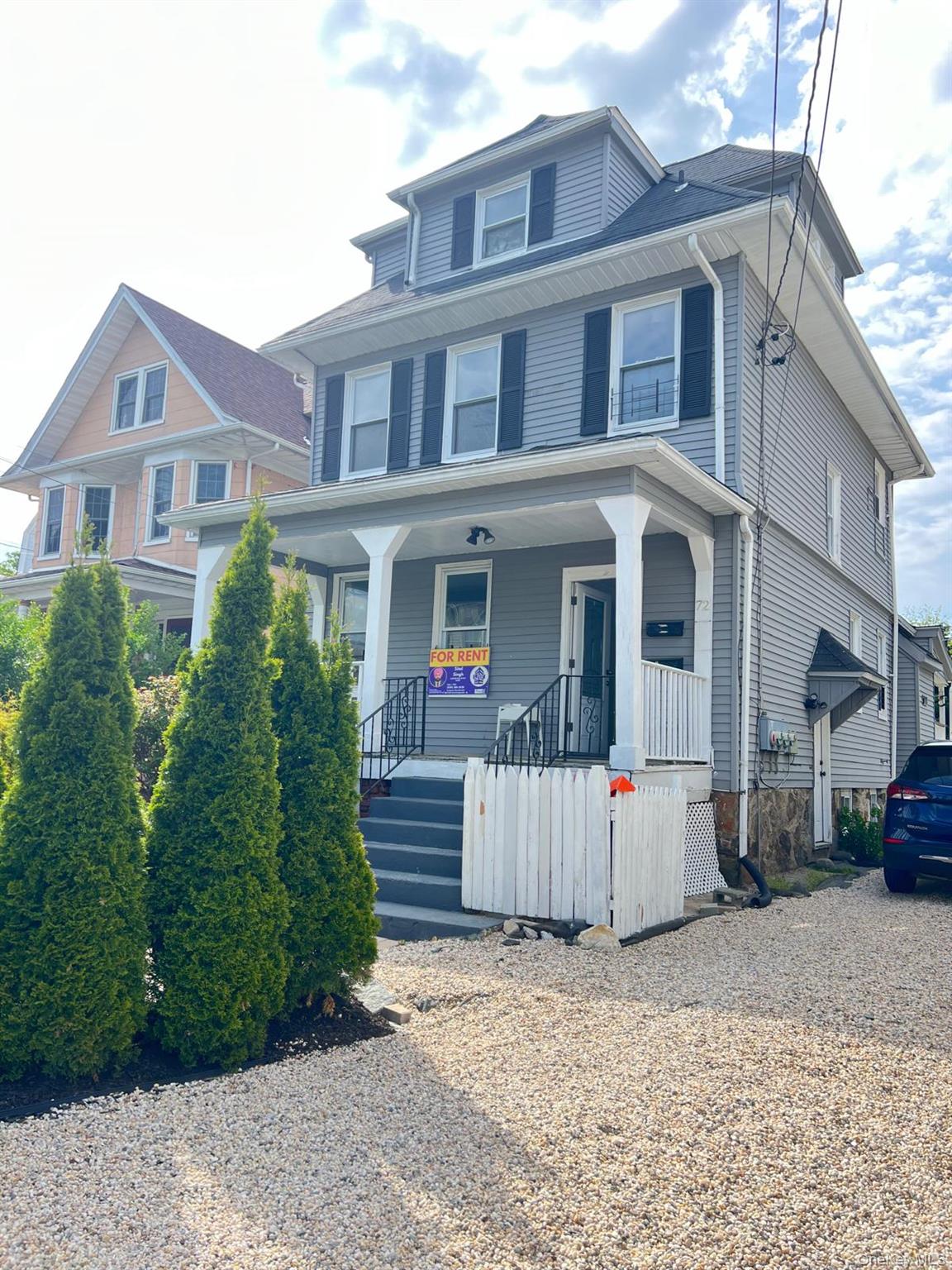 72 Chauncey Avenue